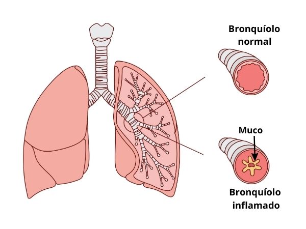 pulmão em destaque para os bronquiolos