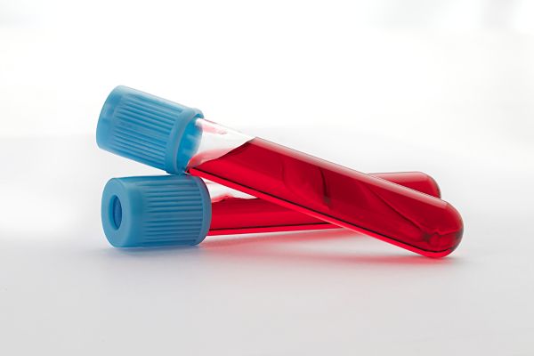 tubos de ensaio com sangue